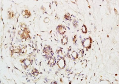 Phospho-Ack1 (Tyr284) Rabbit Polyclonal Antibody